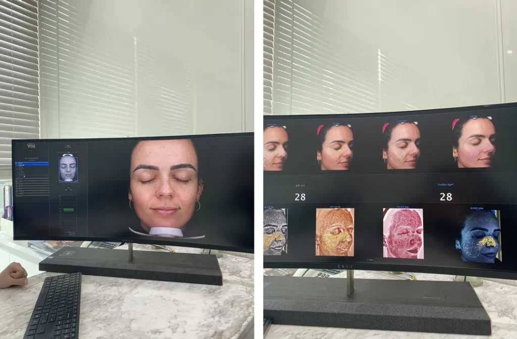 Résultats de l'analyse de peau VISIA à la Medicube Clinic de Séoul montrant l'âge cutané, les pores, les rougeurs et les dommages causés par les UV avant mon soin du visage.
