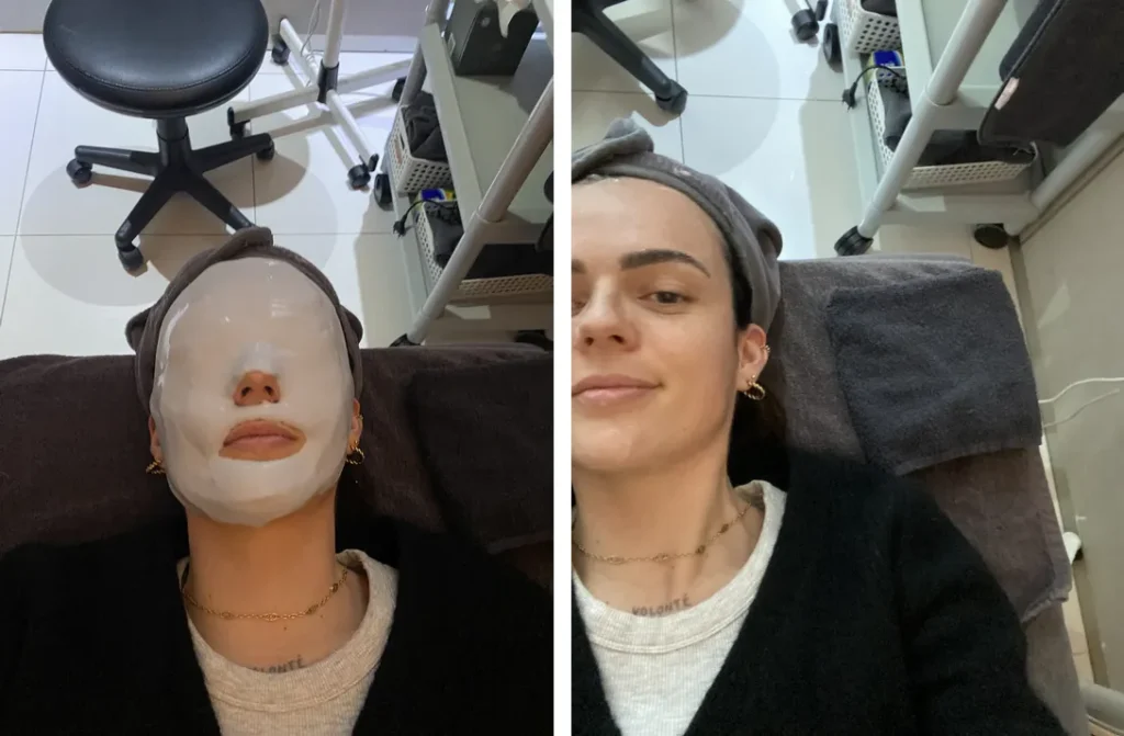 Application d'un Modeling Pack pendant mon soin du visage à Séoul à la Medicube Clinic de Gangnam, suivi du résultat immédiat après le retrait du masque hydratant.